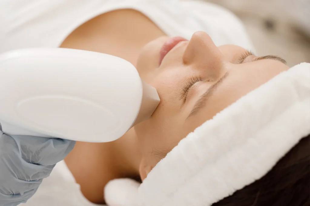 Patient receiving intense pulsed light treatment around the eye area