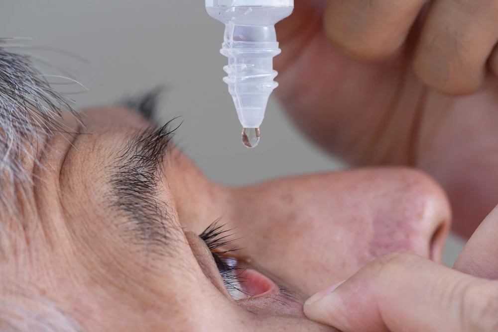 Applying eye drops into the eye