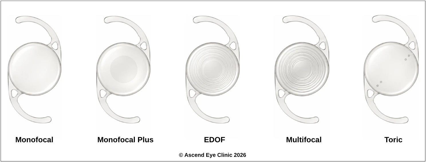 Comparison of monofocal, monofocal plus, EDOF, multifocal and toric intraocular lenses